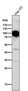 All lanes use the Antibody at 1:1W dilution for 1 hour at room temperature.