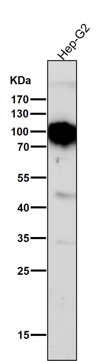 All lanes use the Antibody at 1:1W dilution for 1 hour at room temperature.