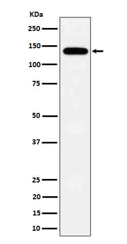 Western blot analysis of Tripeptidyl peptidase II expression in HepG2 cell lysate.