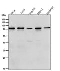 All lanes use the Antibody at 1:1K dilution for 1 hour at room temperature.