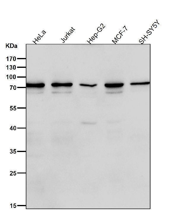 All lanes use the Antibody at 1:1K dilution for 1 hour at room temperature.