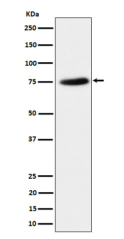 Western blot analysis of PPM1G expression in HeLa cell lysate.