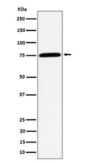 Western blot analysis of PPM1G expression in Jurkat cell lysate.