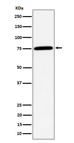 Western blot analysis of PPM1G expression in Jurkat cell lysate.