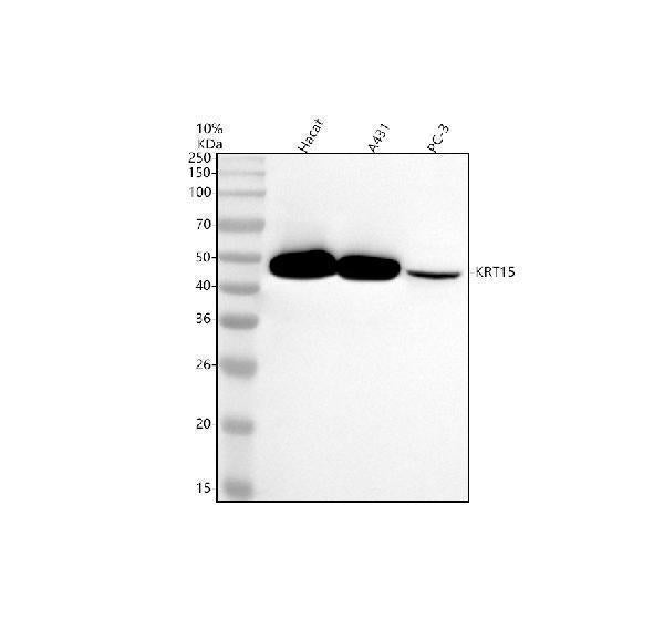 Anti-Cytokeratin 15 Rabbit Monoclonal Antibody