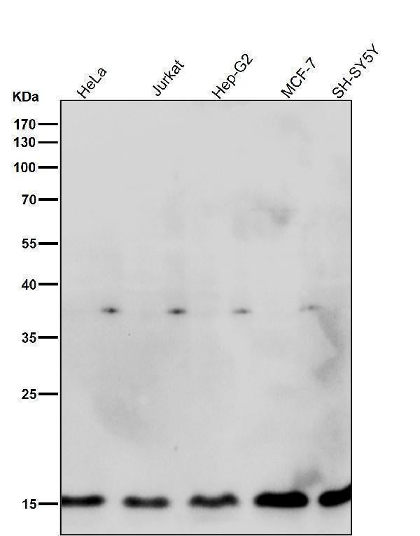 All lanes use the Antibody at 1:5K dilution for 1 hour at room temperature.