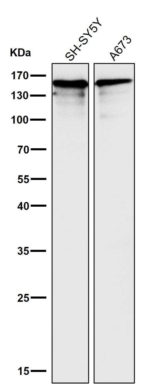 All lanes use the Antibody at 1:3W dilution for 1 hour at room temperature.