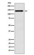 Western blot analysis of Integrin alpha 9 expression in HepG2 cell lysate.