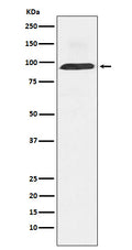 Western blot analysis of Dynamin 3 expression in Human fetal brain lysate.