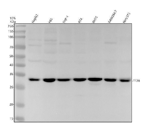 Anti-TF2B Rabbit Monoclonal Antibody