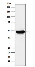 Western blot analysis of ENTPD5 expression in LnCaP cell lysate.