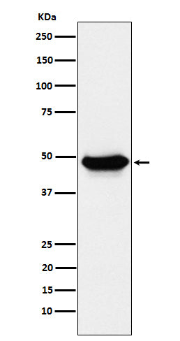 Western blot analysis of ENTPD5 expression in LnCaP cell lysate.