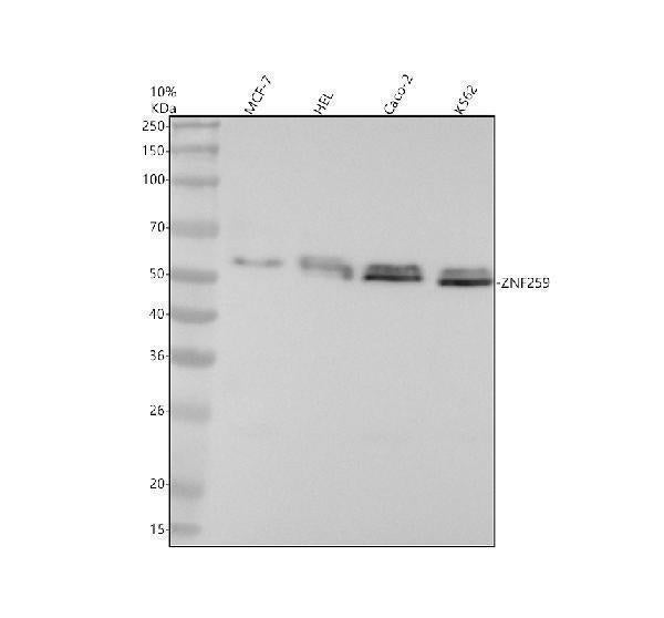 Anti-ZNF259 Rabbit Monoclonal Antibody