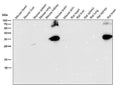 All lanes use the Antibody at 1:5K dilution for 1 hour at room temperature.