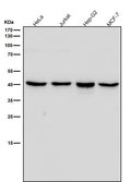 All lanes use the Antibody at 1:3K dilution for 1 hour at room temperature.
