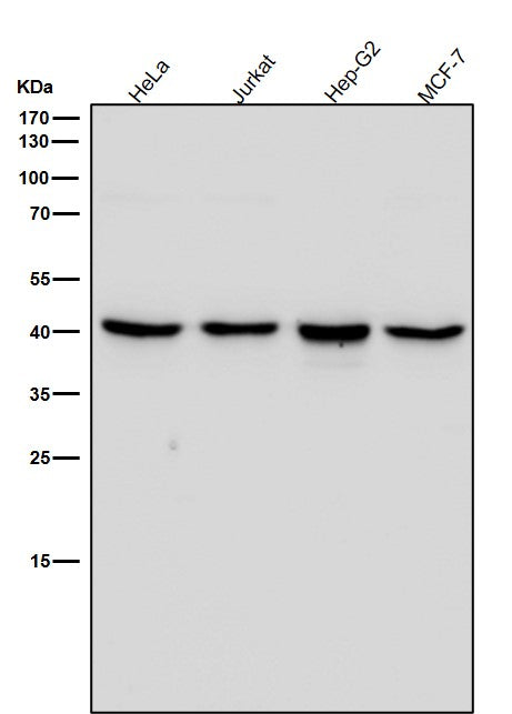 All lanes use the Antibody at 1:3K dilution for 1 hour at room temperature.