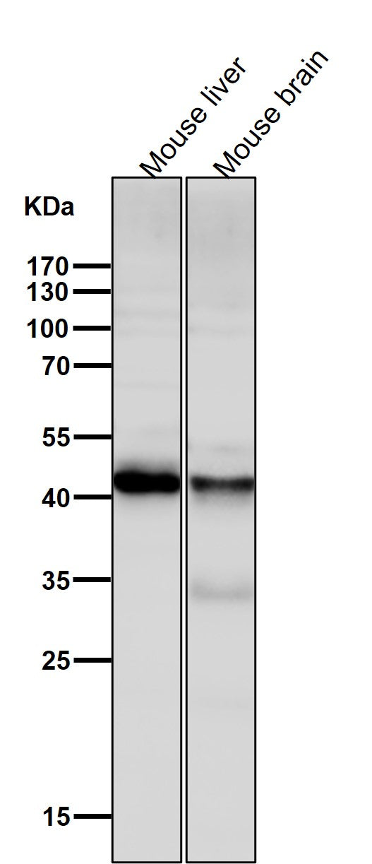 All lanes use the Antibody at 1:2K dilution for 1 hour at room temperature.