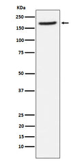 Western blot analysis of Aminopeptidase A / CD249 expression in human fetal lung lysate.