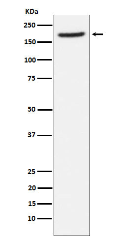 Western blot analysis of Aminopeptidase A / CD249 expression in human fetal lung lysate.