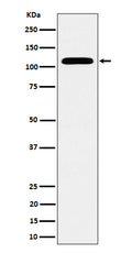 Western blot analysis of SEC24D expression in HeLa cell lysate.