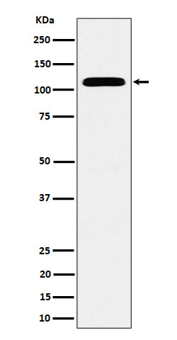 Western blot analysis of SEC24D expression in HeLa cell lysate.