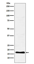 Western blot analysis of TFF2 expression in Human stomach lysate.