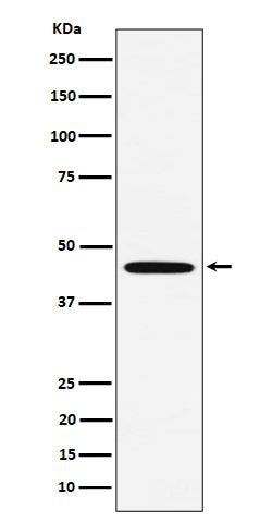 Western blot analysis of MC5 Receptor expression in HeLa cell lysate.