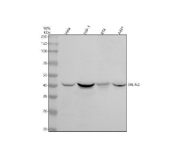 Anti-Erlin-2 Rabbit Monoclonal Antibody