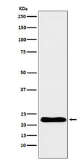 Western blot analysis of TNNI1 expression in Human fetal heart lysate.