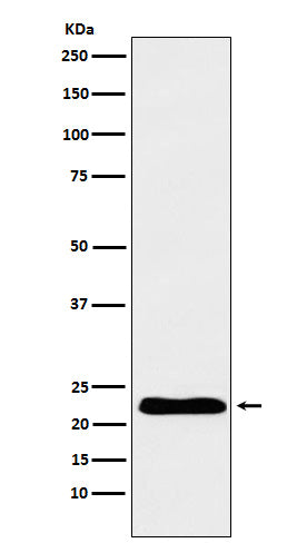Western blot analysis of TNNI1 expression in Human fetal heart lysate.
