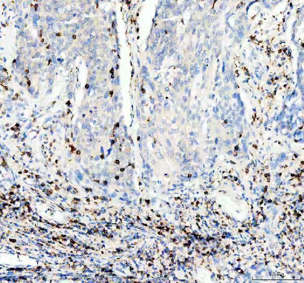 Anti-Integrin alpha E ITGAE Rabbit Monoclonal Antibody