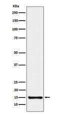Western blot analysis of SAA4 expression in Human plasma cell lysate.