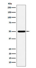 Western blot analysis of ABAT expression in HepG2 cell lysate.