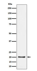 Western blot analysis of CSN8 expression in HepG2 cell lysate.