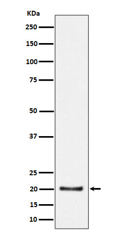 Western blot analysis of CSN8 expression in HepG2 cell lysate.