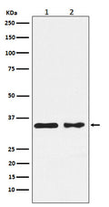 Western blot analysis of CSNK1A1 expression in (1) MCF7 cell lysate; (2) NIH/3T3 cell lysate.