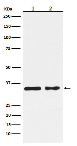 Western blot analysis of CSNK1A1 expression in (1) MCF7 cell lysate; (2) NIH/3T3 cell lysate.