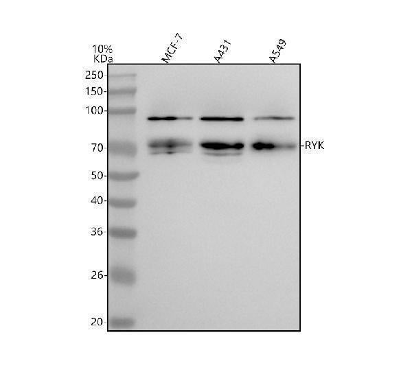 Anti-RYK Rabbit Monoclonal Antibody