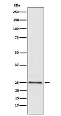 Western blot analysis of Lysophospholipase 1 expression in Human fetal liver lysate.
