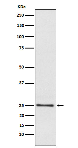 Western blot analysis of Lysophospholipase 1 expression in Human fetal liver lysate.