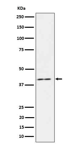 Western blot analysis of IL18 binding protein in HeLa cell lysate.