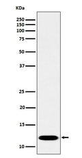 Western blot analysis of PCBD1 expression in Caco-2 cell lysate.