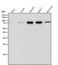All lanes use the Antibody at 1:1W dilution for 1 hour at room temperature.