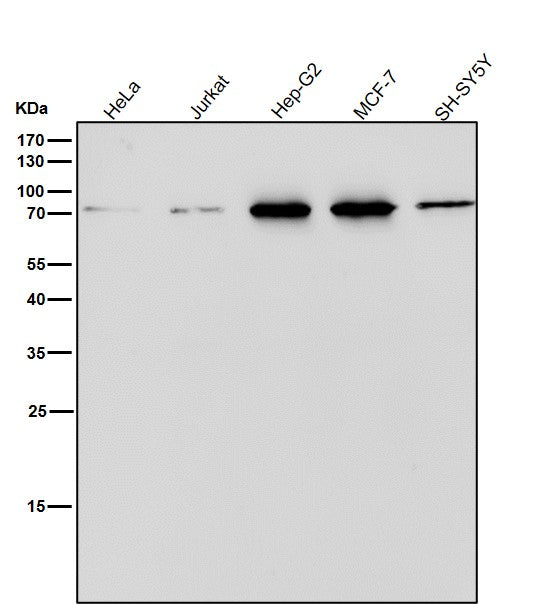 All lanes use the Antibody at 1:1W dilution for 1 hour at room temperature.