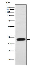 Western blot analysis of Troponin I fast skeletal muscle expression in Human skeletal muscle lysate.