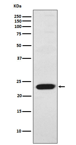Western blot analysis of Troponin I fast skeletal muscle expression in Human skeletal muscle lysate.