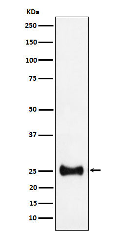 Western blot analysis of Adenylate kinase 4 expression in HepG2 cell lysate.