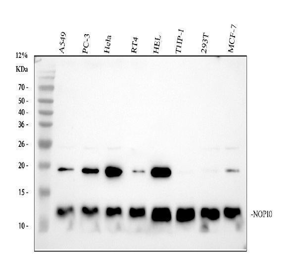 Anti-NOP10 Rabbit Monoclonal Antibody