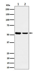 Western blot analysis of AAMP expression in (1) A375 lysate; (2) MCF7 cell lysate.