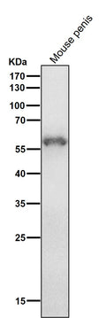 All lanes use the Antibody at 1:1K dilution for 1 hour at room temperature.
